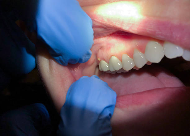 Best Tooth Pain Emergency Relief  in Melody Hill, IN